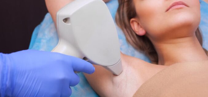 Laser To Hair Removal: A Breakdown of the Technology and How it Works